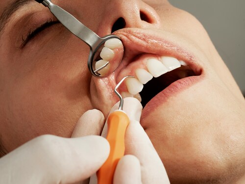 Qualities That Make A Good Dentist Suited For Your Dental Needs